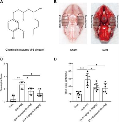 6-Gingerol attenuates subarachnoid hemorrhage-induced early brain injury via GBP2/PI3K/AKT pathway in the rat model